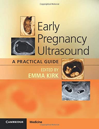 Early Pregnancy Ultrasound: A Practical Guide
