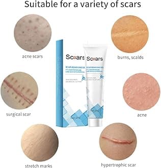 Organic Scar Removing Gel, Scar Removal Cream for Old and New Scars, Advanced Scar Gel for Face Body, Scar Repair Gel Cream for Man and Women